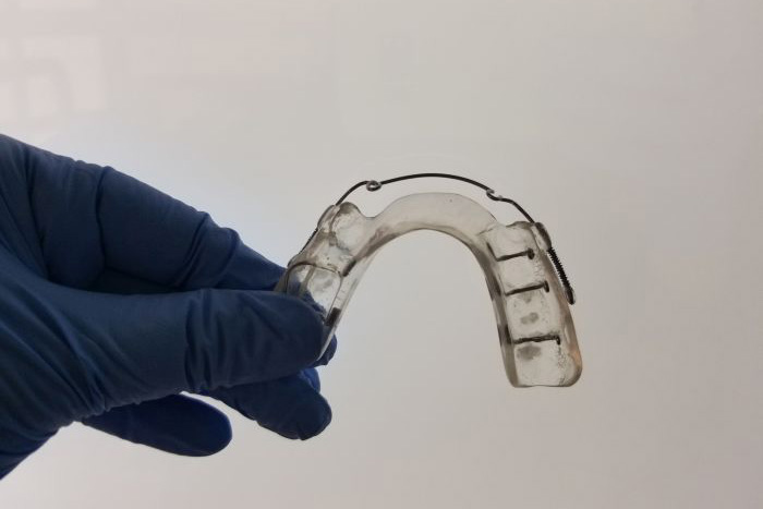 Ortodontista de Curitiba desenvolve aparelho dentário para minimizar maloclusão em pacientes com ELA