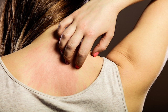 Alergias: saiba como acontecem e conheça as mais comuns