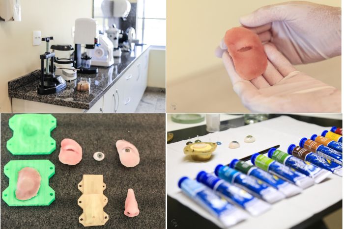 Laboratório produz próteses gratuitas para pacientes oncológicos